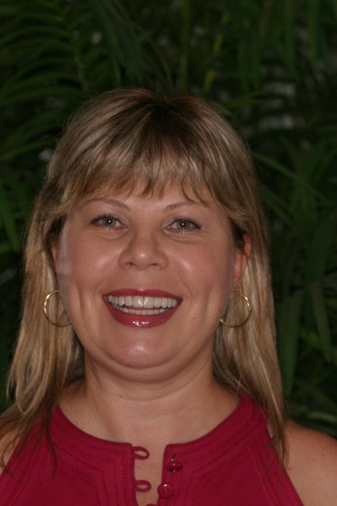 Woman smiling After Porcelain Veneers