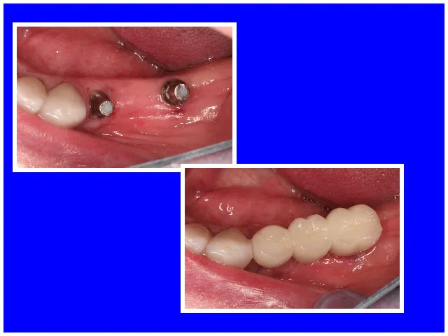 Wellington Center for Laser Dentistry
