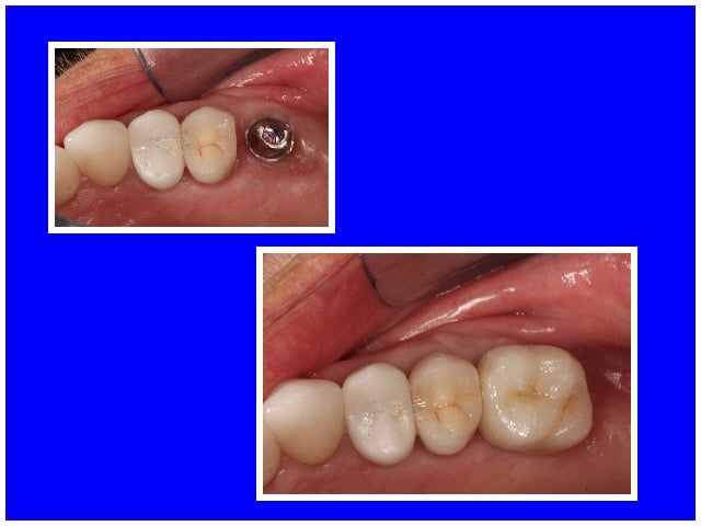 Wellington Center for Laser Dentistry