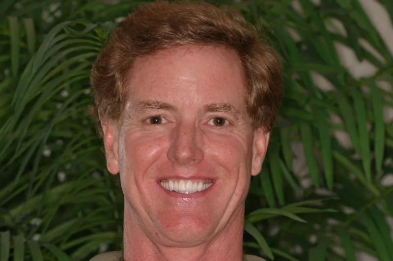 William Genz smiling after Full Mouth Reconstruction
