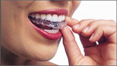 Invisign Clear Aligners, the Invisible way to straighten teeth