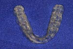 Occlusal Orthotic Appliance is similar to a nightguard