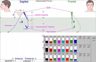 final bite position computer illustration