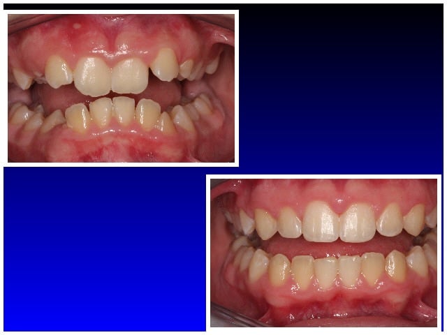 Before Treatment & After Treatment
