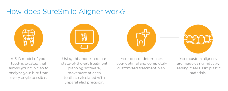 SureSmile Aligners information on how they work