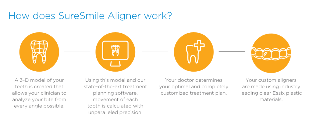 SureSmile Aligners information on how they work