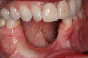 Oral cancer examination