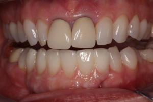 Oral cancer examination
